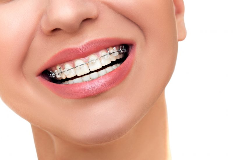 especialistas en ortodoncia